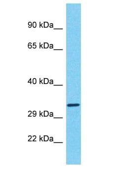 Polyclonal Rabbit anti-Human LGALS9 / Galectin 9 Antibody (aa71-120, WB)