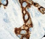 Acidic Cytokeratin AE1 Antibody (clone AE1, Ready-to-Use)