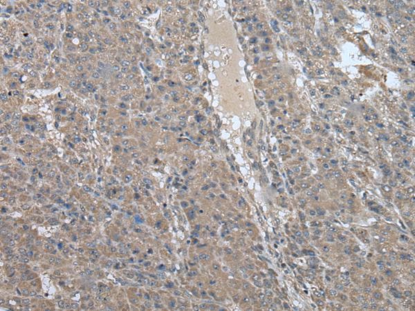 Polyclonal Rabbit anti-Human USP32 Antibody (IHC)