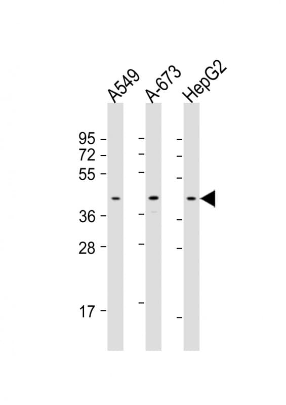 CSNK2A3 / CSNK2A1P Antibody (aa296-330)