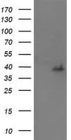MAP2K3 / MEK3 / MKK3 Antibody (clone OTI4B3)