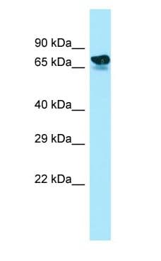 ARHGAP22 / RhoGAP2 Antibody (aa573-622)