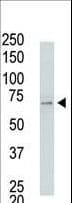 Polyclonal Rabbit anti-Human USP2 Antibody (aa380-410, WB)