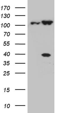 Monoclonal Mouse anti-Human CSE1L Antibody (clone OTI5H9, aa1-300, WB)