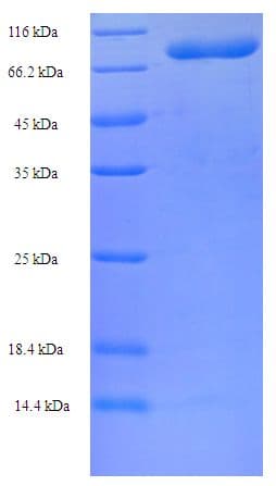 Human CCT2 / CCT Beta Protein (Recombinant His-SUMO)