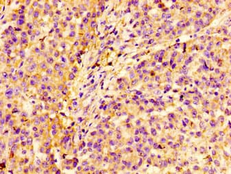 IHC-plus™ LIMS1 / PINCH Antibody