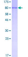 Human ALB / Serum Albumin Protein (Recombinant GST)