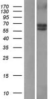 ALK3 / BMPR1A Protein (Over-Expression Lysate Myc-DDK (Flag))