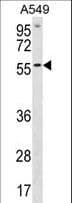 ETV5 / ERM Antibody (aa8-37)