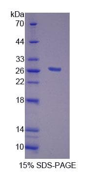 Human FGF20 Protein (Recombinant His-T7, N-terminus)