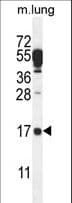 DTD2 Antibody (aa136-164)