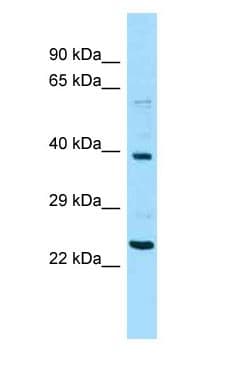 Polyclonal Rabbit anti-Human NPIPA1 / NPIP Antibody (aa131-180, WB)