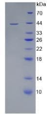 Human CD4 Protein (Recombinant His)
