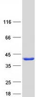 Human REEP2 Protein (Recombinant Myc-DDK (Flag))