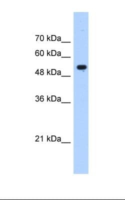 Polyclonal Rabbit anti-Human IFIT3 Antibody (aa51-100, IHC, WB)