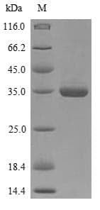 Bordetella bronchiseptica BB3856 Protein (Recombinant 6His-SUMOstar, N-terminus)