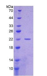 Human CYFRA21-1 Protein (Recombinant His, N-Terminal)