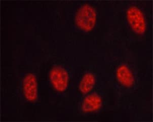PRKDC / DNA-PKcs Antibody (phospho-Thr2647)