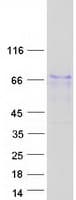 Human BMP3 Protein (Recombinant Myc-DDK (Flag))