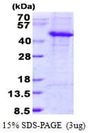 Human DKK3 Protein (Recombinant His)