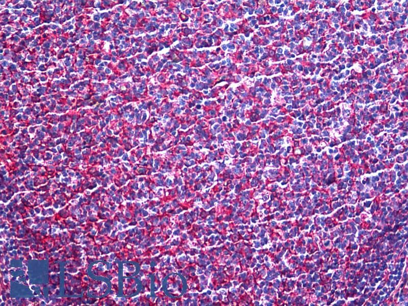 IHC-plus™ MARCKS Antibody (clone 2C2)