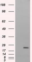 Monoclonal Mouse anti-Human NIT2 Antibody (clone OTI5A3, IHC, IF, WB)