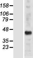 ALX / HSH2D Protein (Over-Expression Lysate Myc-DDK (Flag))