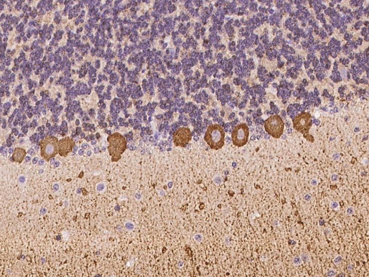 Polyclonal Rabbit anti-Human HPCA / Hippocalcin Antibody (IHC)