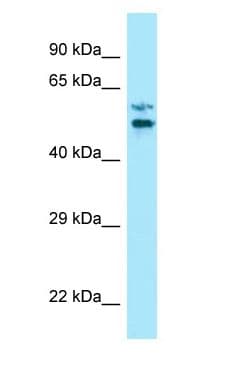 Polyclonal Rabbit anti-Human LTV1 Antibody (C-Terminus, WB)