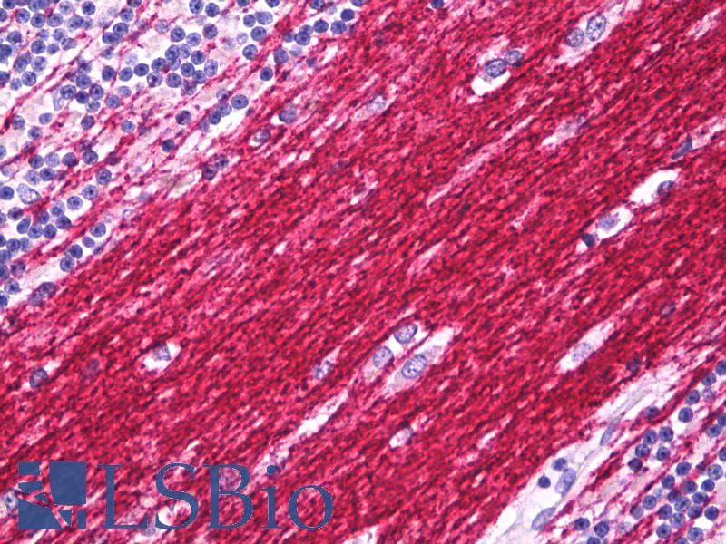 IHC-plus™ PLP1 / Myelin PLP Antibody (C-Terminus)