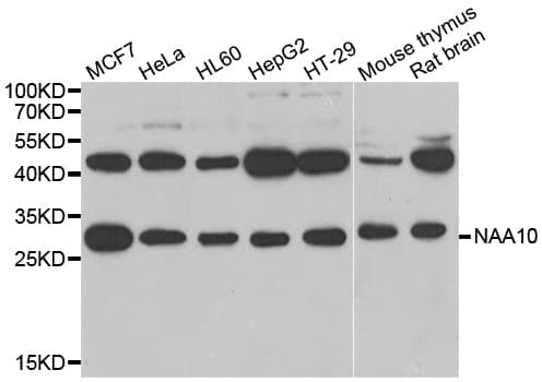 NAA10 / ARD1A Antibody