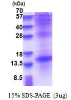 Human TSHB / TSH-Beta Protein (Recombinant His)