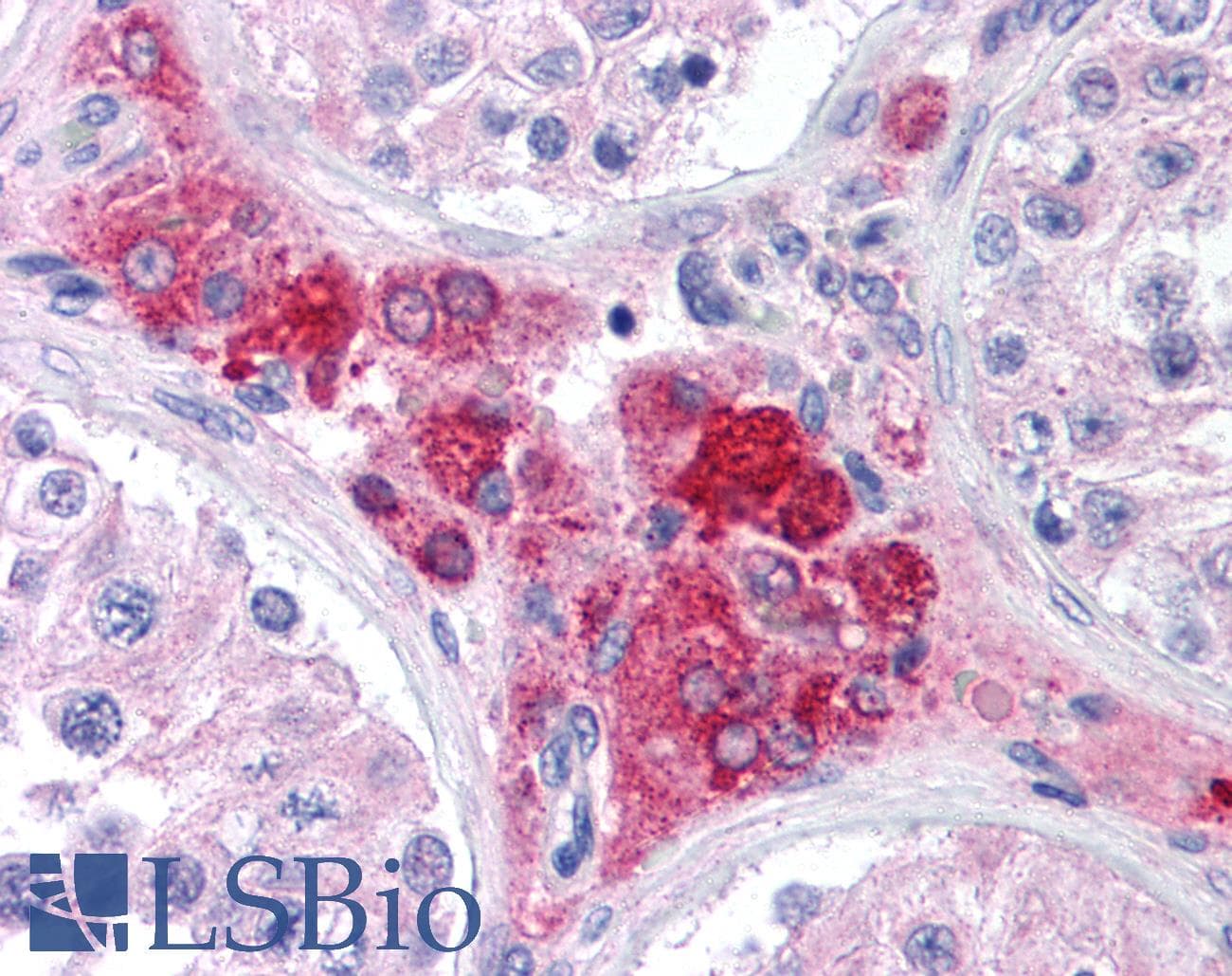 IHC-plus™ SCP1 / SYCP1 Antibody (C-Terminus)