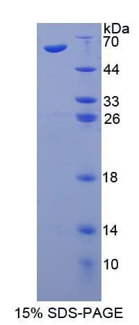 Human ATM Protein (Recombinant His-GST-S)