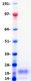 Human TIGIT Protein (Recombinant DDK (Flag)-His, C-terminus)