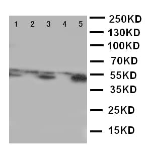 ALDH3A1 Antibody (aa440-453)
