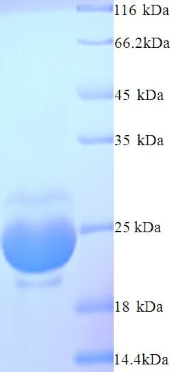 Onchocerca volvulus OV-16 Antigen Protein (Recombinant His)