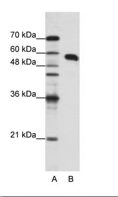NONO / P54NRB Antibody (N-Terminus)