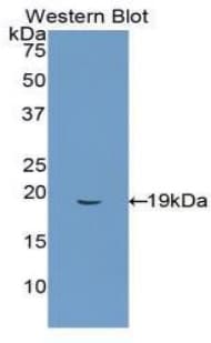 HMOX1 / HO-1 Antibody (aa61-172)