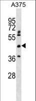 ASPHD2 Antibody (aa165-194)