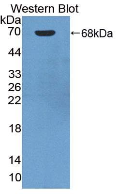 Angiostatin Antibody (aa100-434)