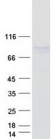 Human LPO / Lactoperoxidase Protein (Recombinant Myc-DDK (Flag))