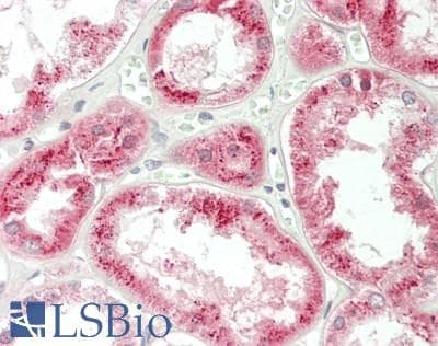 IHC-plus™ Polyclonal Rabbit anti-Human KLHL9 Antibody (aa299-326, IHC, WB)