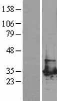 PGAM1 Protein (Over-Expression Lysate Myc-DDK (Flag))