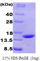 Human CHGA / Chromogranin A Protein (Recombinant)