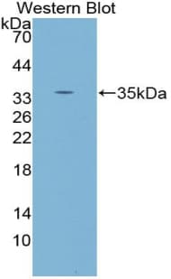 PRKCG / PKC-Gamma Antibody (aa351-614)
