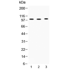 ADAM2 / Fertilin Beta Antibody