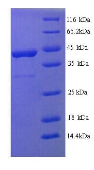 Human FGFR3 Protein (Recombinant His)