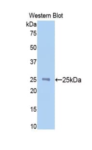 NAGA Antibody (aa218-415, APC)