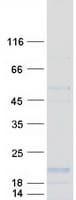Human CD59 Protein (Recombinant Myc-DDK (Flag))